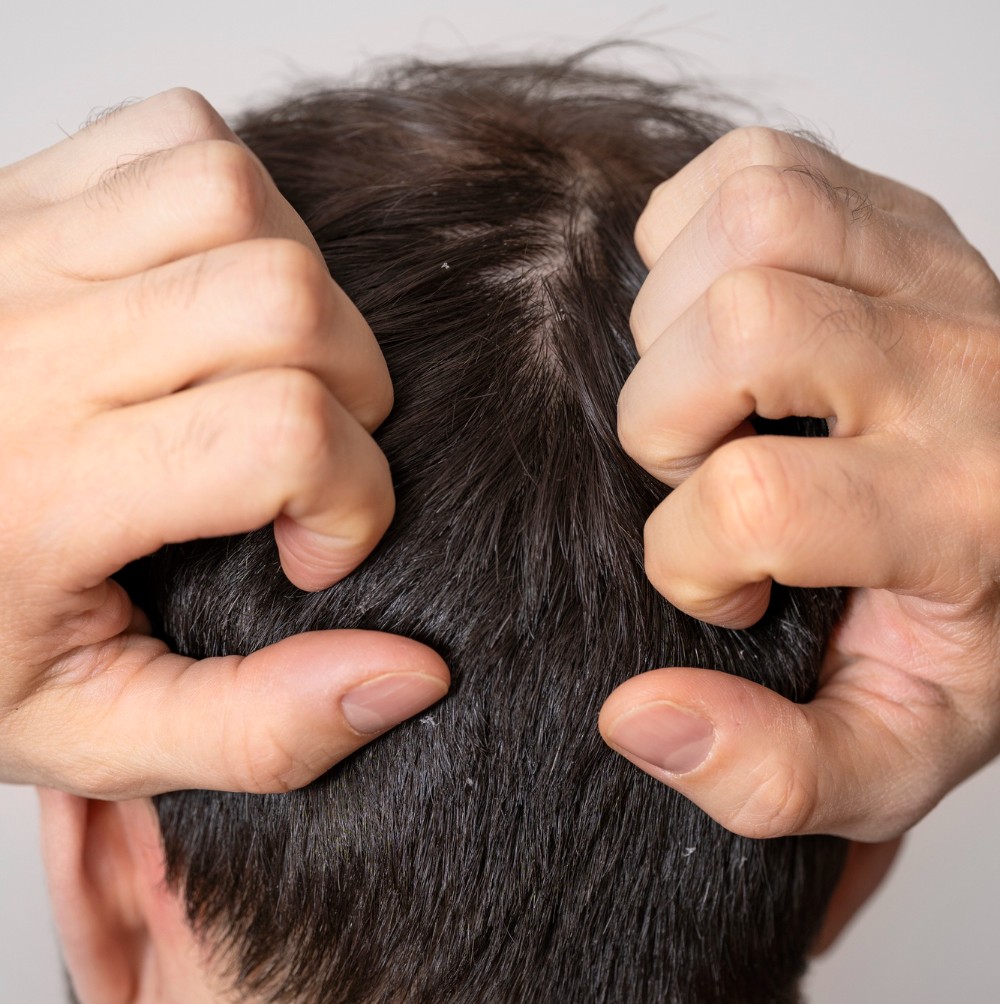 FUT Hair Transplant